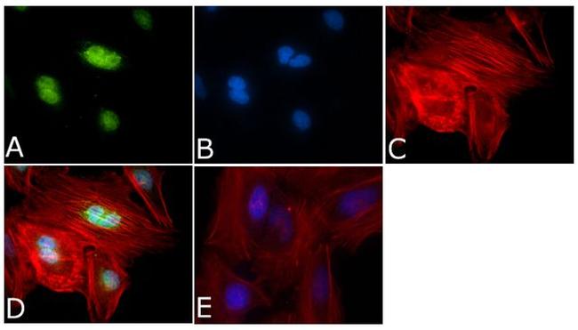 Aurora B Antibody in Immunocytochemistry (ICC/IF)