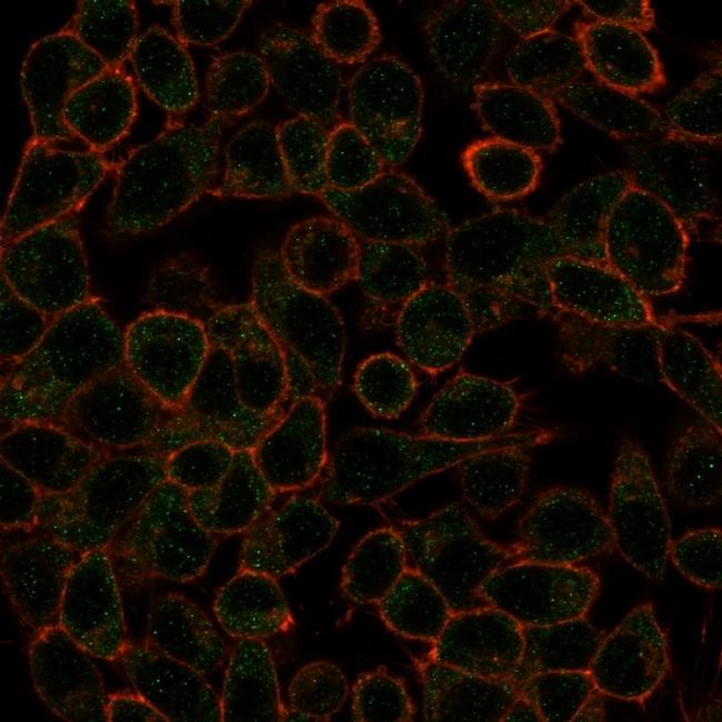 IRF3 Antibody in Immunocytochemistry (ICC/IF)