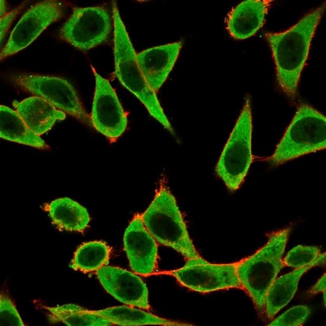 IRF3 Antibody in Immunocytochemistry (ICC/IF)