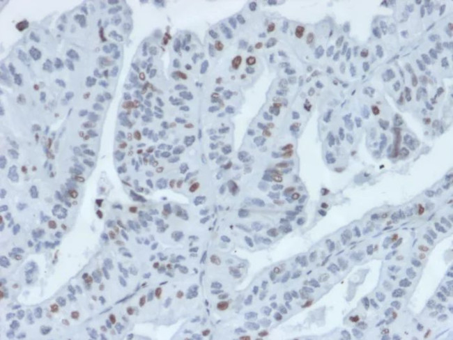 IRF3 (Transcription Factor) Antibody in Immunohistochemistry (Paraffin) (IHC (P))