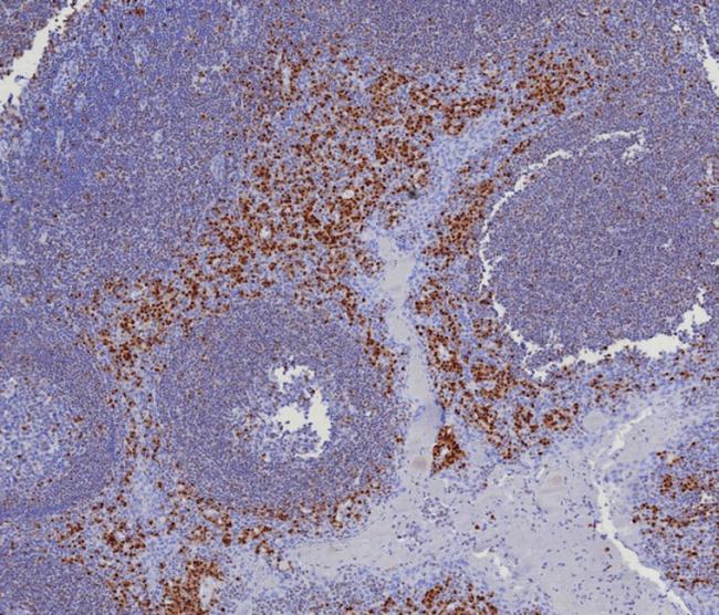 MUM1/IRF4 (Transcription Factor) Antibody in Immunohistochemistry (Paraffin) (IHC (P))