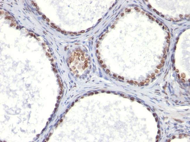 Androgen Receptor (Marker of Androgen Dependence) Antibody in Immunohistochemistry (Paraffin) (IHC (P))