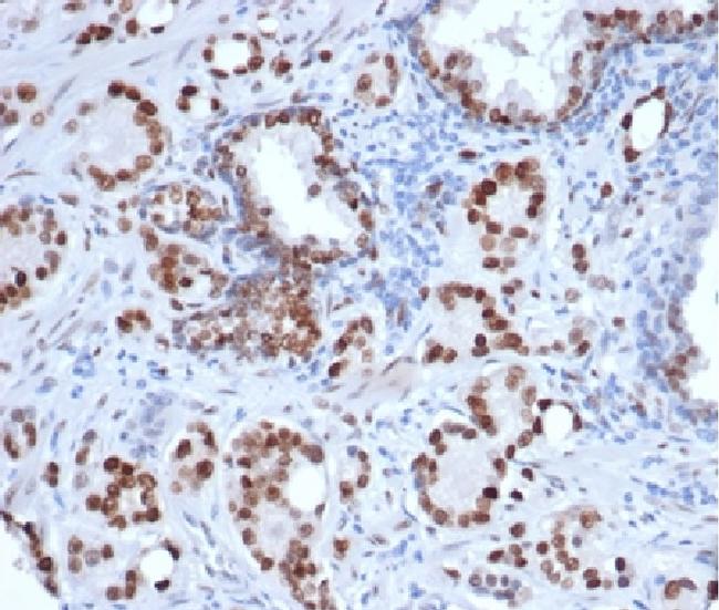 Androgen Receptor Antibody in Immunohistochemistry (Paraffin) (IHC (P))