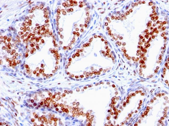 Androgen Receptor (Marker of Androgen Dependence) Antibody in Immunohistochemistry (Paraffin) (IHC (P))