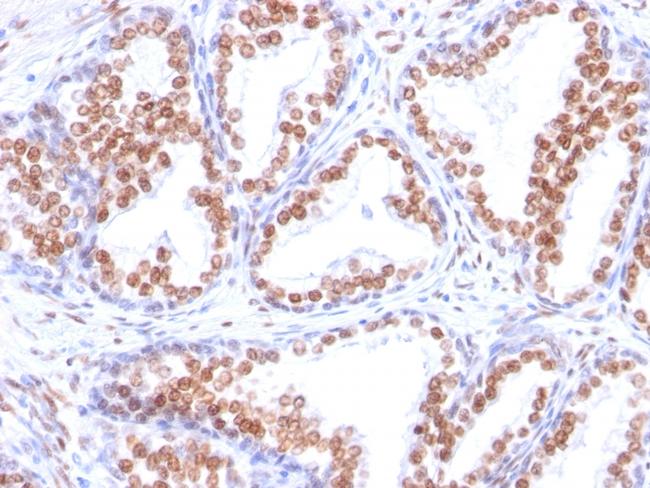 Androgen Receptor (Marker of Androgen Dependence) Antibody in Immunohistochemistry (Paraffin) (IHC (P))