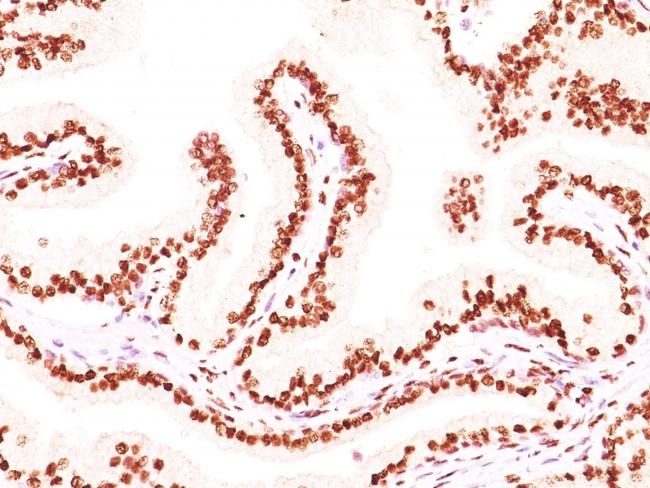 Androgen Receptor (Marker of Androgen Dependence) Antibody in Immunohistochemistry (Paraffin) (IHC (P))