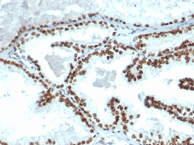 Androgen Receptor Antibody in Immunohistochemistry (Paraffin) (IHC (P))