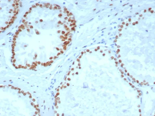 Androgen Receptor (Marker of Androgen Dependence) Antibody in Immunohistochemistry (Paraffin) (IHC (P))