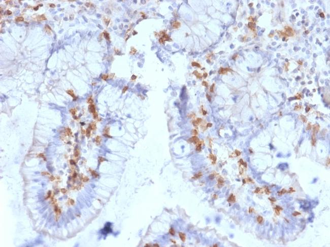 CD103/Integrin E7 Antibody in Immunohistochemistry (Paraffin) (IHC (P))