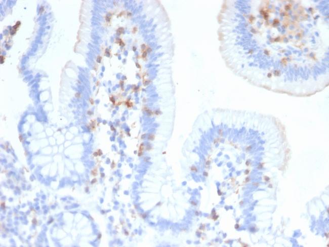 CD103/Integrin alpha E (T-Cell Lymphoma and Hairy Cell Leukemia Marker) Antibody in Immunohistochemistry (Paraffin) (IHC (P))