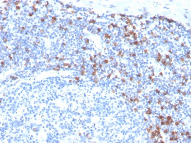 CD103/Integrin alpha-E-beta7 Antibody in Immunohistochemistry (Paraffin) (IHC (P))