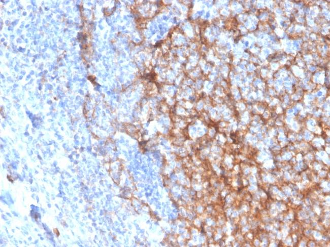 CD11b/MAC-1 (Microglial Marker) Antibody in Immunohistochemistry (Paraffin) (IHC (P))