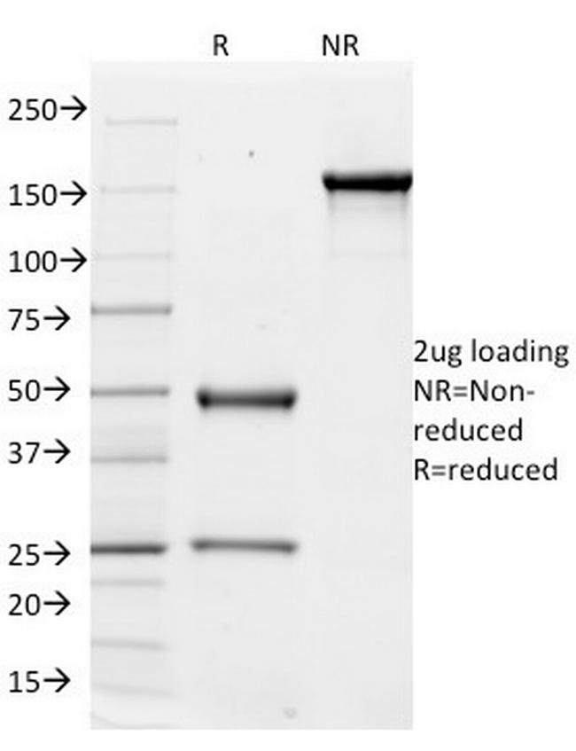 CD51/Integrin V Antibody in SDS-PAGE (SDS-PAGE)