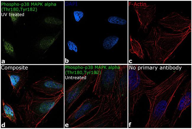 Phospho-p38 MAPK (Thr180, Tyr182) Antibody in Immunocytochemistry (ICC/IF)