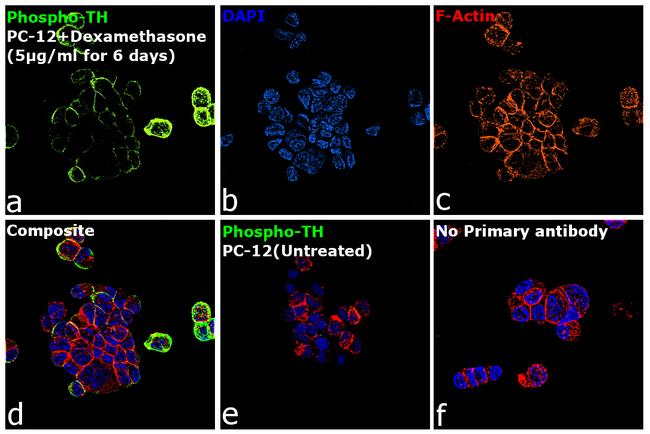 Phospho-Tyrosine Hydroxylase (Ser40) Antibody in Immunocytochemistry (ICC/IF)