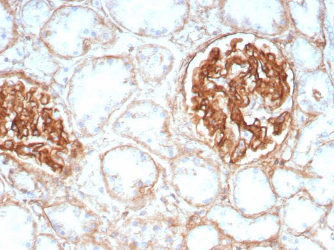 CD29 (Stem Cell Marker) Antibody in Immunohistochemistry (Paraffin) (IHC (P))