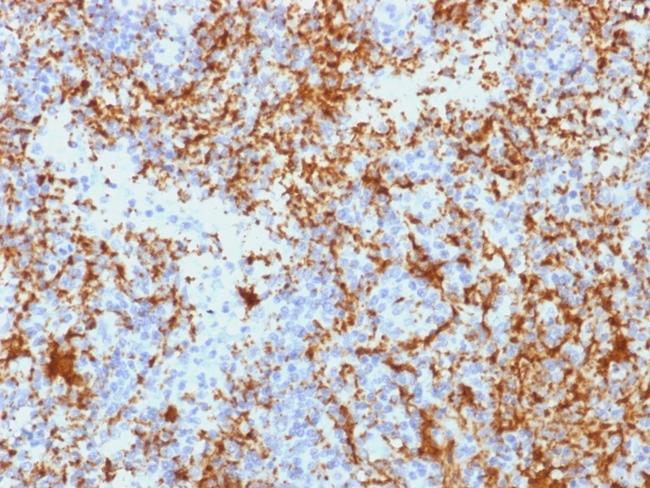 CD61/Integrin 3/Platelet Glycoprotein IIIa (Platelet Marker) Antibody in Immunohistochemistry (Paraffin) (IHC (P))