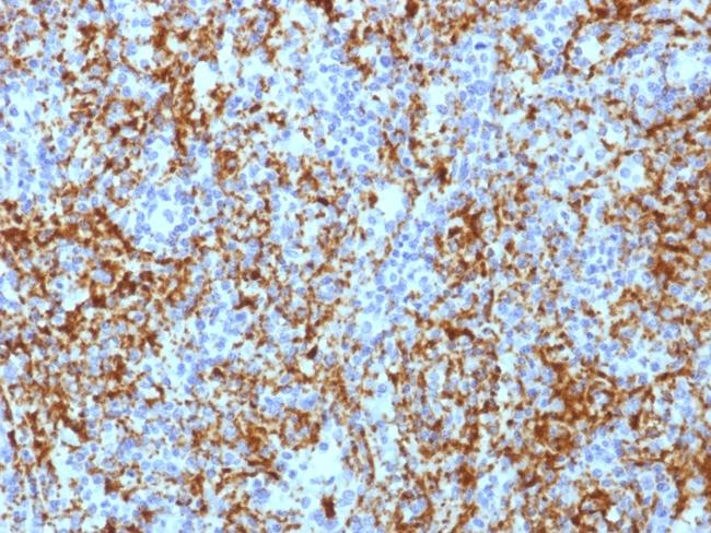 CD61/Integrin 3/Platelet Glycoprotein IIIa (Platelet Marker) Antibody in Immunohistochemistry (Paraffin) (IHC (P))