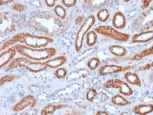 CD61/Integrin beta-3/Platelet Glycoprotein IIIa Antibody in Immunohistochemistry (Paraffin) (IHC (P))