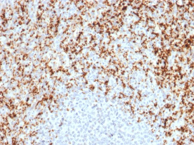 CD61/Integrin 3/Platelet Glycoprotein IIIa (Platelet Marker) Antibody in Immunohistochemistry (Paraffin) (IHC (P))