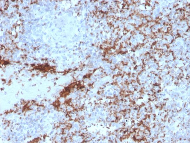 CD61/Integrin '3/Platelet Glycoprotein IIIa (Platelet Marker) Antibody in Immunohistochemistry (Paraffin) (IHC (P))