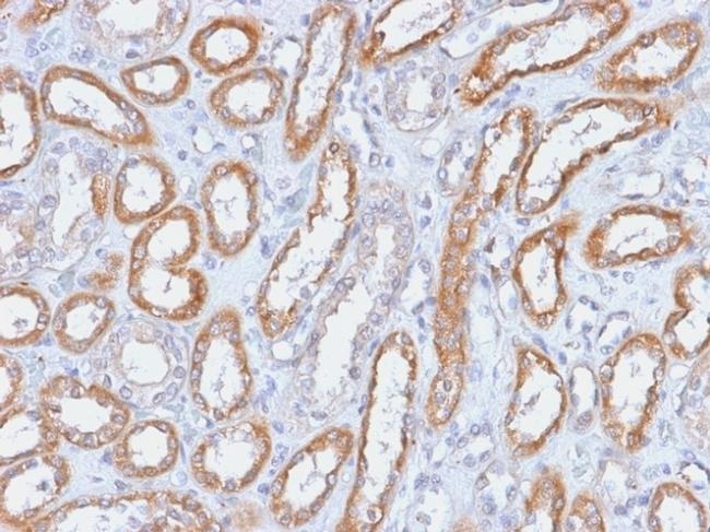 CD61/Integrin 3/Platelet Glycoprotein IIIa Antibody in Immunohistochemistry (Paraffin) (IHC (P))