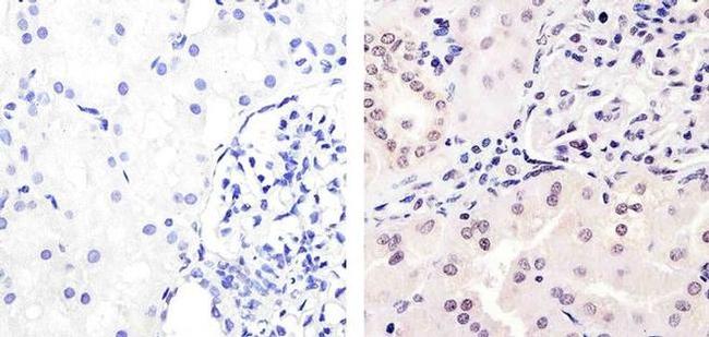 Phospho-PAX2 (Ser393) Antibody in Immunohistochemistry (Paraffin) (IHC (P))