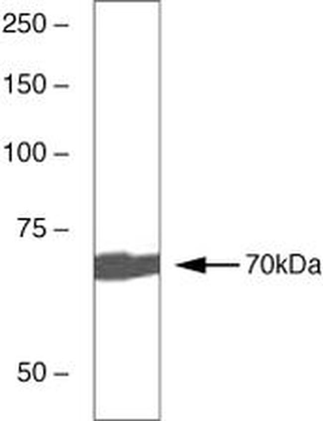 Zap-70 Antibody in Western Blot (WB)