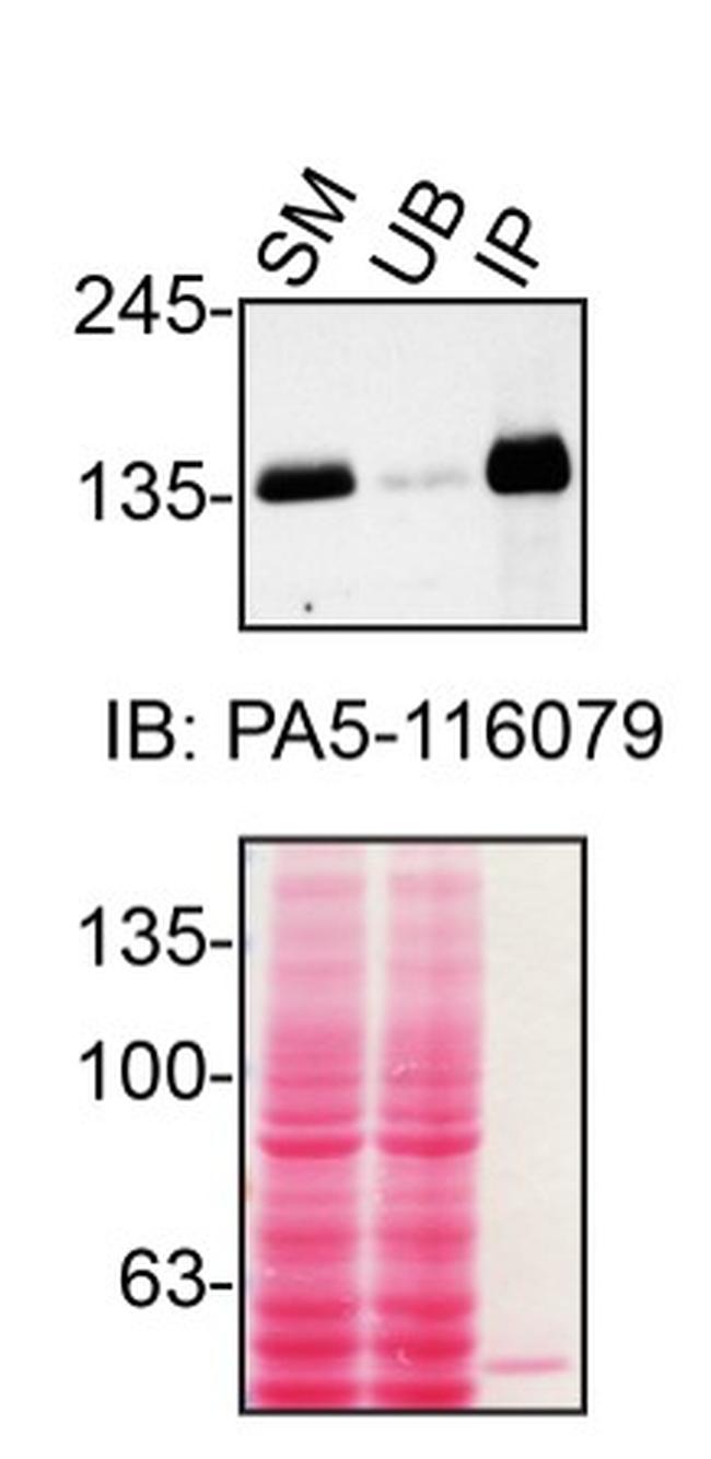 TSC1 Antibody in Immunoprecipitation (IP)