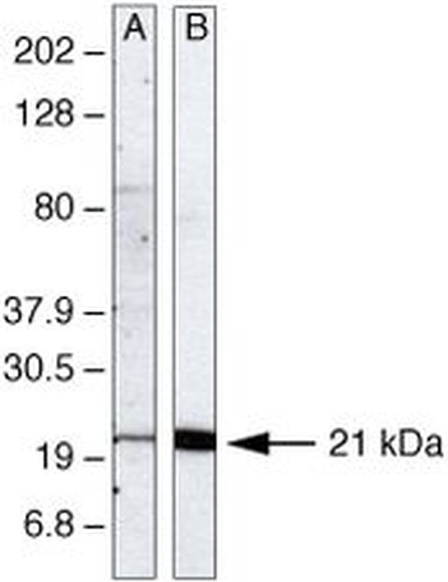 UBC13 Antibody in Western Blot (WB)