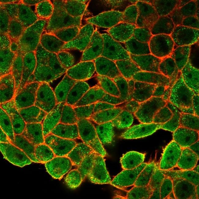 JunB/Transcription Factor JunB Antibody in Immunocytochemistry (ICC/IF)