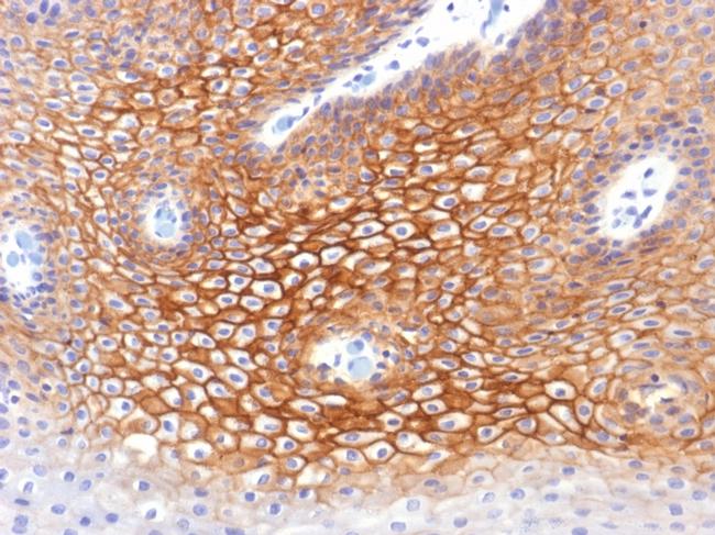 Catenin, gamma Antibody in Immunohistochemistry (Paraffin) (IHC (P))