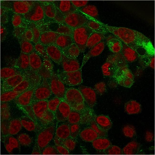 Catenin, gamma (Cardiomyocyte Marker) Antibody in Immunocytochemistry (ICC/IF)