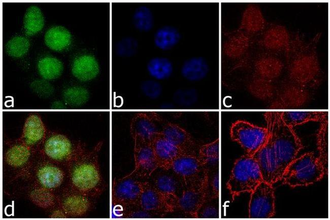 RPL11 Antibody in Immunocytochemistry (ICC/IF)