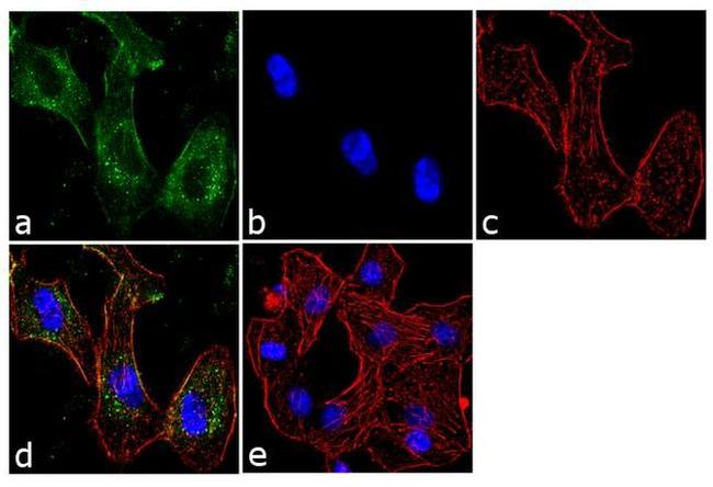 BTRC Antibody in Immunocytochemistry (ICC/IF)