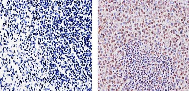 SOCS1 Antibody in Immunohistochemistry (Paraffin) (IHC (P))