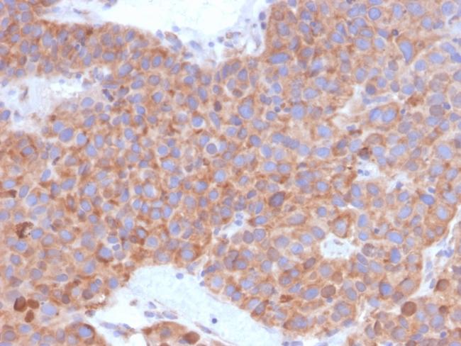 B7-H6/NCR3LG1 (Natural Killer Cell Cytotoxicity Receptor 3 Ligand 1) Antibody in Immunohistochemistry (Paraffin) (IHC (P))