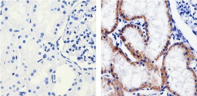 Claudin 1 Antibody in Immunohistochemistry (Paraffin) (IHC (P))