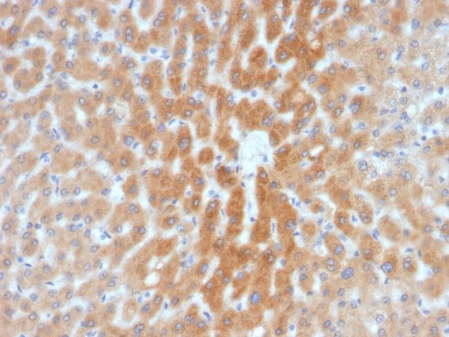 ARF1 (Golgi Apparatus Marker) Antibody in Immunohistochemistry (Paraffin) (IHC (P))