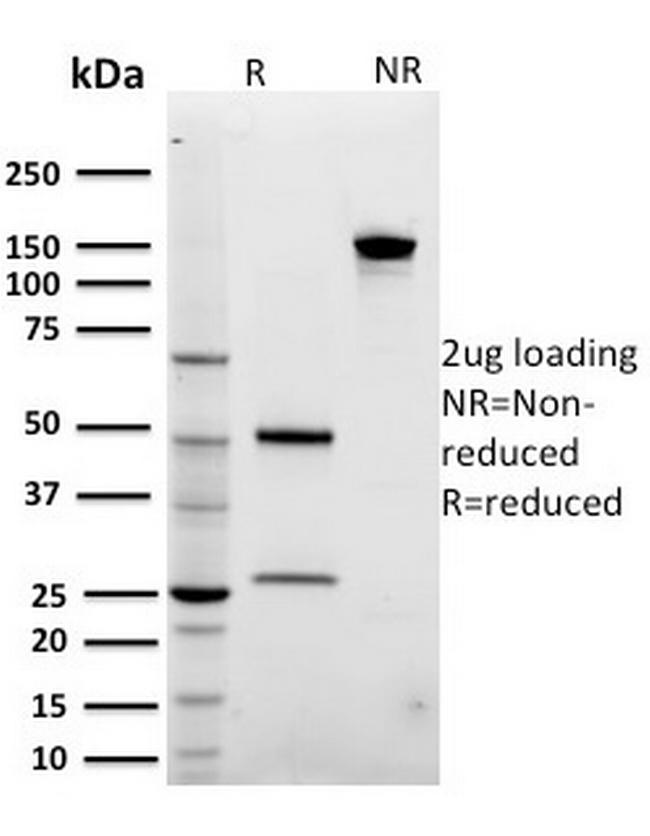 ARF1 (Golgi Apparatus Marker) Antibody in SDS-PAGE (SDS-PAGE)