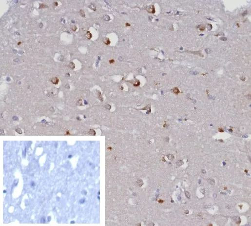 GIRK2 (Interleukin-6)/Interferon beta-2 (Hybridoma Growth Factor) Antibody in Immunohistochemistry (Paraffin) (IHC (P))