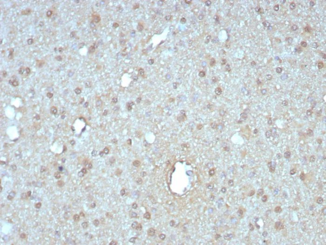 GIRK2 (Interleukin-6)/Interferon beta-2 (Hybridoma Growth Factor) Antibody in Immunohistochemistry (Paraffin) (IHC (P))