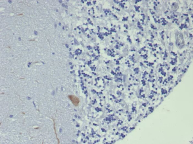 GIRK2 (Interleukin-6)/Interferon beta-2 (Hybridoma Growth Factor) Antibody in Immunohistochemistry (Paraffin) (IHC (P))