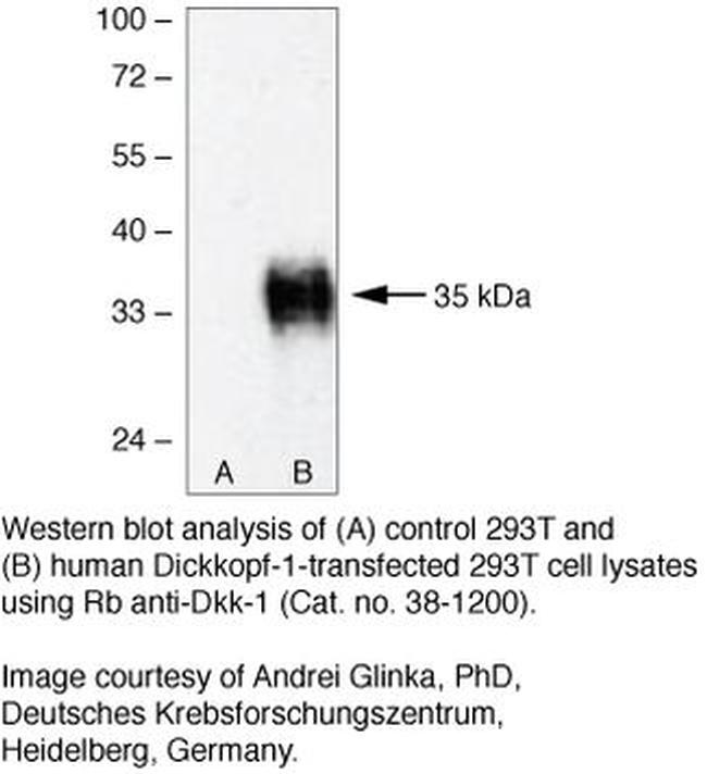 DKK1 Antibody in Western Blot (WB)