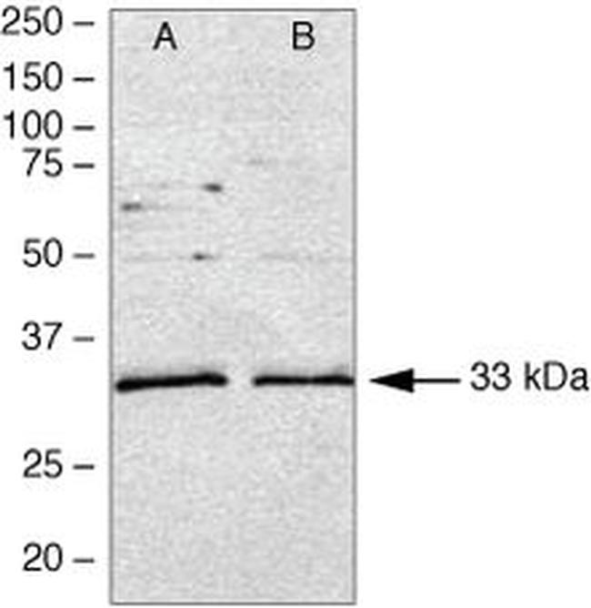 MyD88 Antibody in Western Blot (WB)