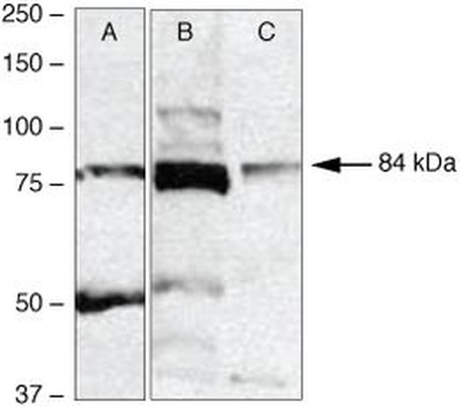 RSK2 Antibody in Western Blot (WB)