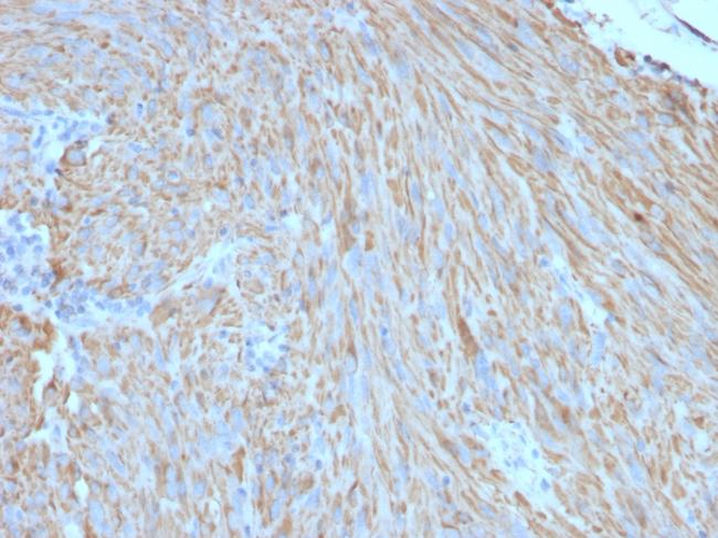 CD117/c-Kit (Marker for Gastrointestinal Stromal Tumors) Antibody in Immunohistochemistry (Paraffin) (IHC (P))