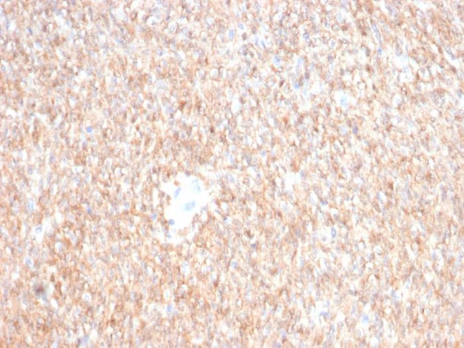 CD117/c-Kit (Marker for Gastrointestinal Stromal Tumors) Antibody in Immunohistochemistry (Paraffin) (IHC (P))