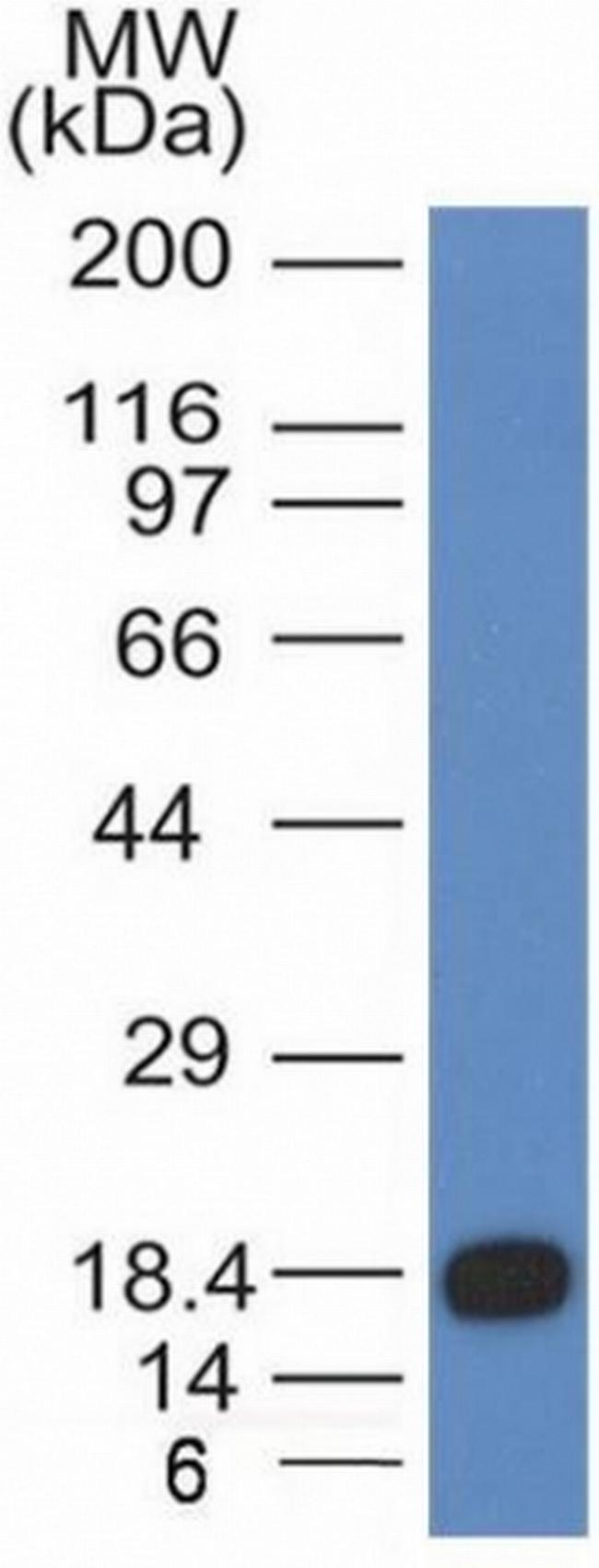 CD117/c-Kit (Marker for Gastrointestinal Stromal Tumors) Antibody in Western Blot (WB)