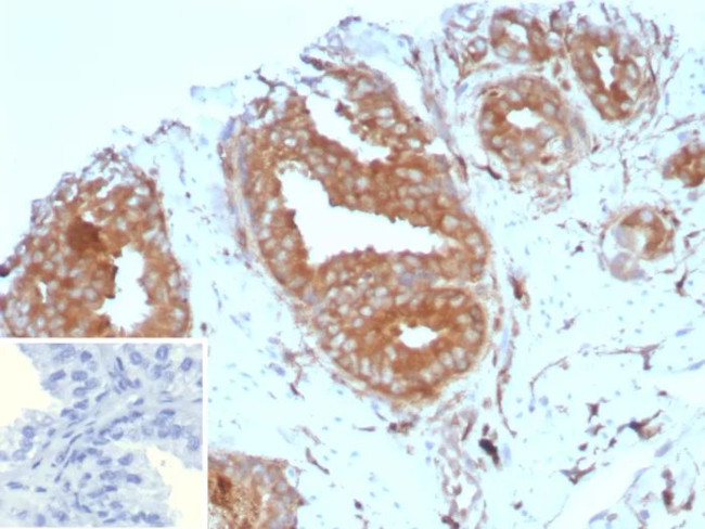 CD161/KLRB1 (Killer cell lectin like receptor B1) Antibody in Immunohistochemistry (Paraffin) (IHC (P))